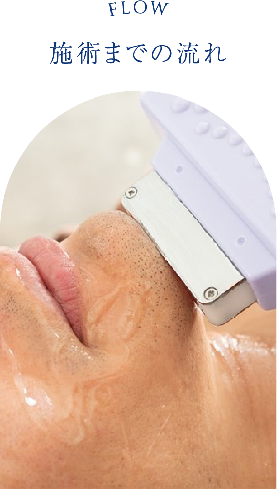 施術までの流れ